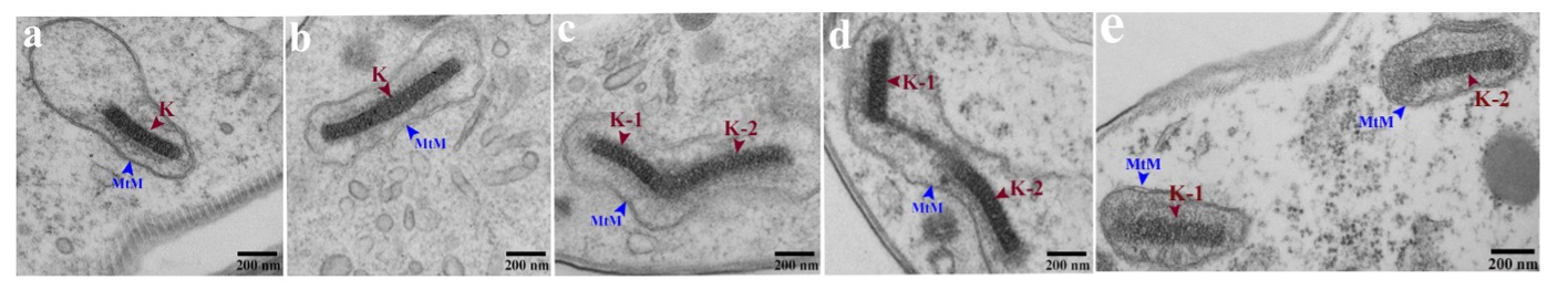 Photo of Electron Microscope Images of Kinetoplasts at Different Stages of Division or Partitioning