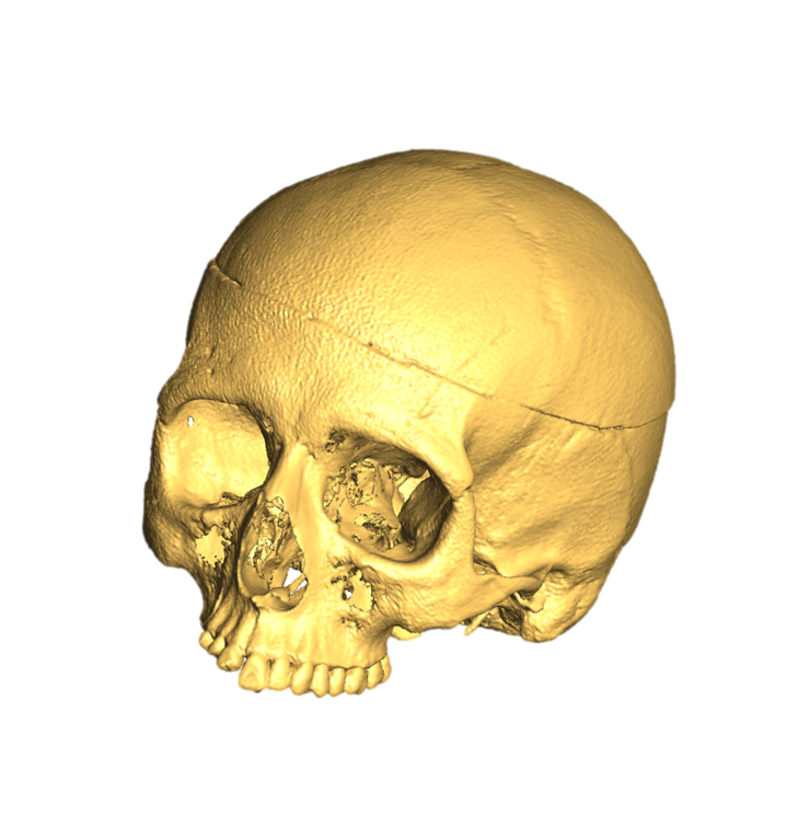 Avizo skull